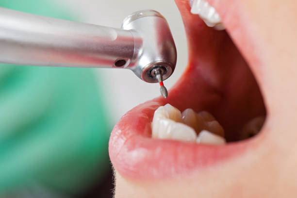 Reliable WV Emergency Dentist Solutions